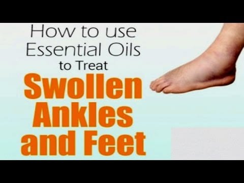 How to Use Essential Oils to Treat Swollen Ankles and Feet