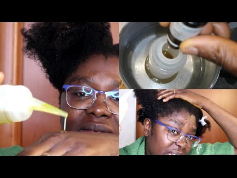 How I Mix My Hot Oil Treatment For Scalp Inflammation, Soreness, Itchy, Bornt And Tenderness