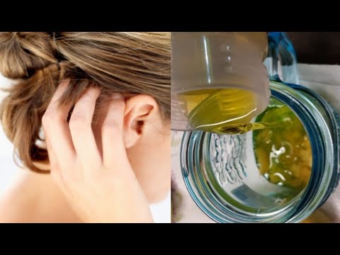 Scalp Emergency Inflammation Sore Scalp And Other How To Calm It Down
