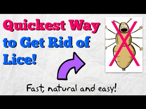 How to Get Rid of Lice FAST! | Home Remedy to Kill Head Lice Naturally