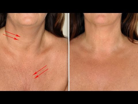 How to Get Rid of Chest and Neck Wrinkles Naturally