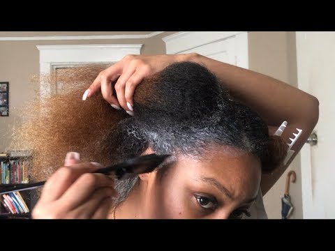 Grow Back HAIR AND EDGES FAST! | Monistat 7 Scalp Treatment for Hair Growth