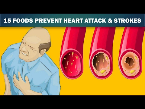 15 Foods That Unclog Your Arteries Naturally Like Magic