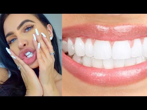 DIY REMOVE PLAQUE & TARTAR FROM TEETH AT HOME (100% WORKS) | How To NATURALLY Get Whitest Teeth Ever