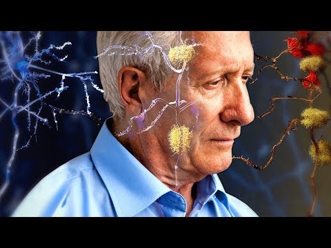 Alzheimer’s or Forgetfulness? How to Tell the Difference