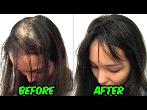 DIY Natural Hair Thickening Oil Recipe To Regrow Hair And Stop Hair Thinning