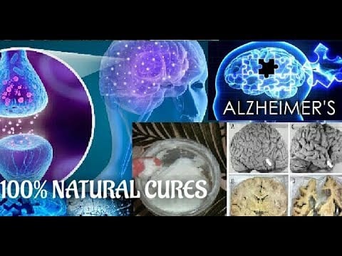 How I Naturally Stopped & Reversed Alzheimer’s Disease & Dementia| Natural Cures Home Remedies@