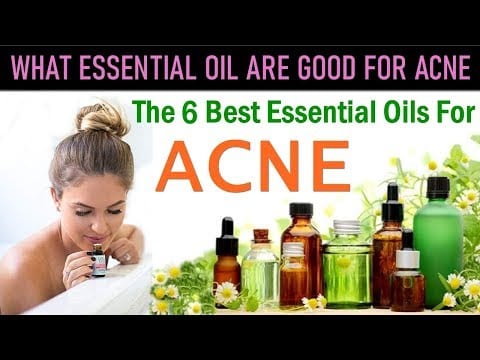 What Essential Oils are Good for Acne – The 6 Best Essential Oils For Acne